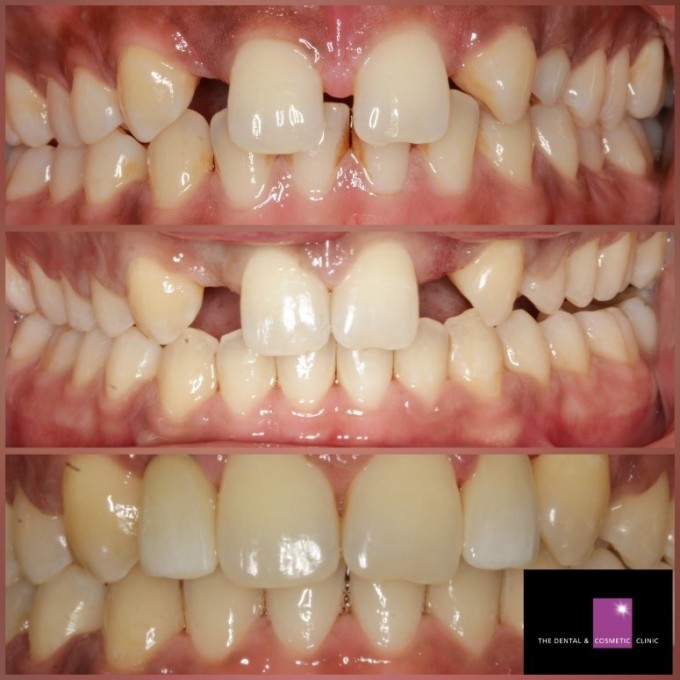 case9-before